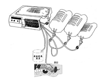腹膜透析設備注冊審查指導原則(2024年修訂版)(2024年第19號)(圖1) 腹膜透析設備注冊審查指導原則(2024年修訂版)(2024年第19號)(圖1)