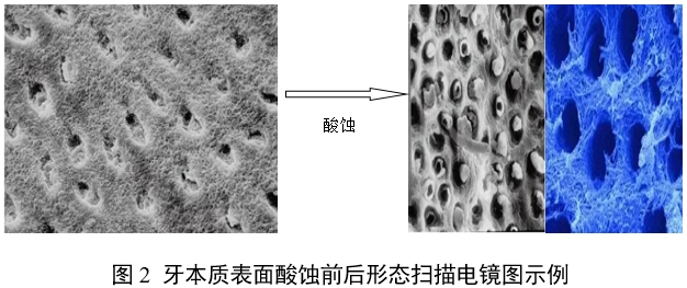 牙科用磷酸酸蝕劑注冊審查指導(dǎo)原則（2022年第41號）(圖2)