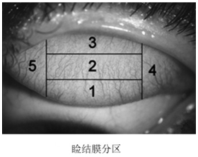 接觸鏡護理產(chǎn)品注冊審查指導原則（2023年修訂版）（2023年第9號）(圖7)