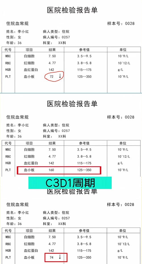 AE與研究藥物關(guān)系記錄不一致，如何處理？